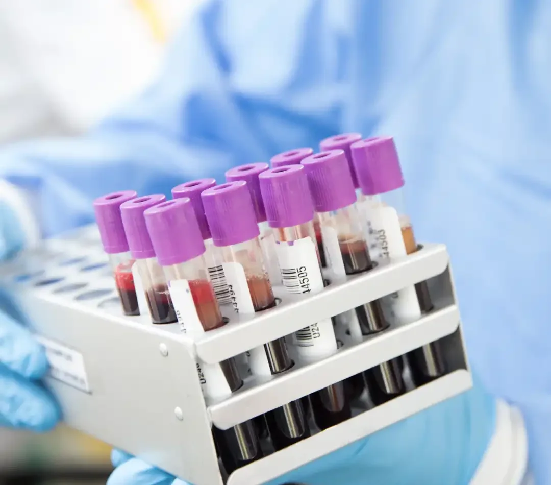 Sample and Reception – Lab Design Work Flow Bottlenecks – OnePointe Solutions Sample and Reception - Lab Design Work Flow Bottlenecks - OnePointe Solutions